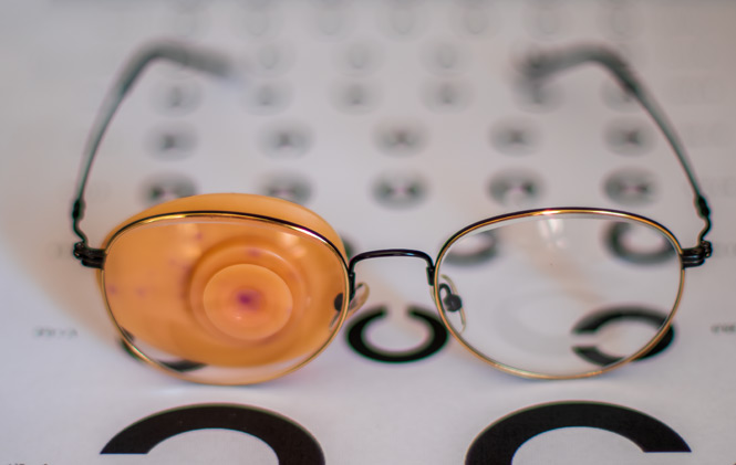 약시 치료, 약시 뜻, 약시 교정, 약시 라식, 성인 약시