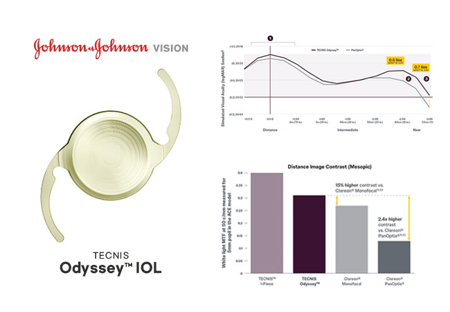 40대 백내장, 40대 노안, 40대 녹내장, 백내장 노안, 노안 오는 나이