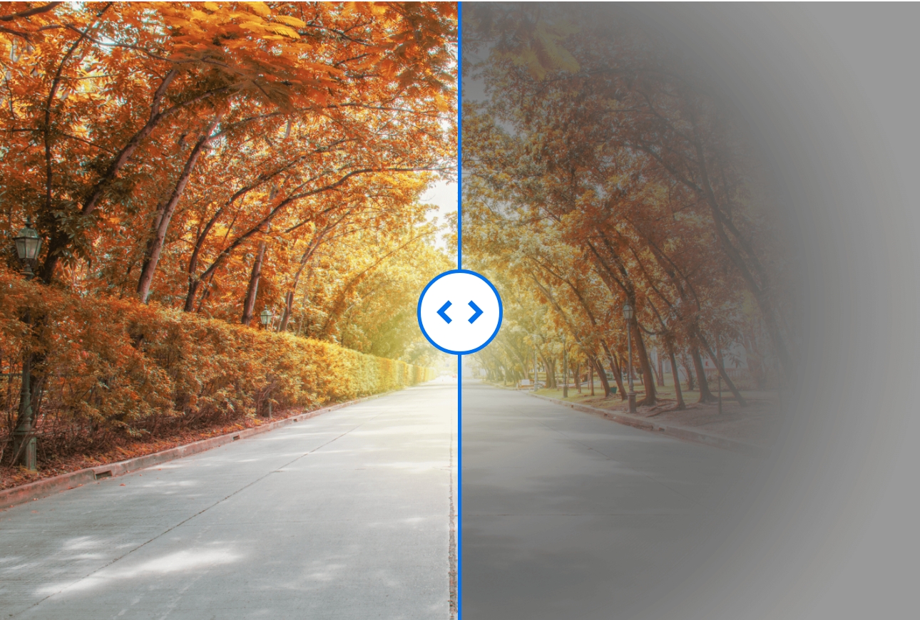 녹내장 안약, 녹내장 약, 녹내장 치료 방법, 녹내장 안과, 녹내장 완치 가능